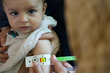 A child aged under-2 stares into a camera as a measurement is taken of her arm circumference with a WFP-logo tape